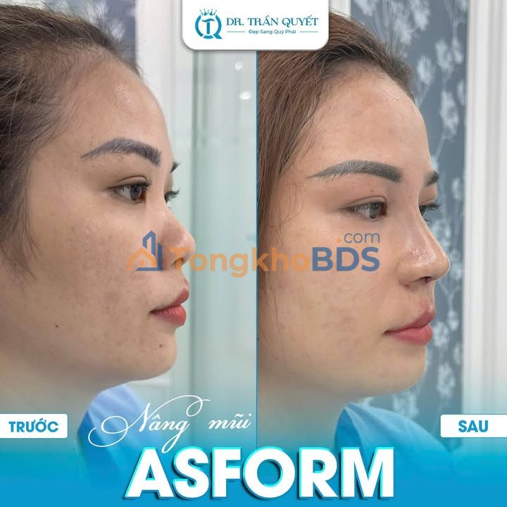 Đất nền Tiền Hải, Thái Bình 150m² - Sổ đỏ sẵn, tiềm năng tăng giá